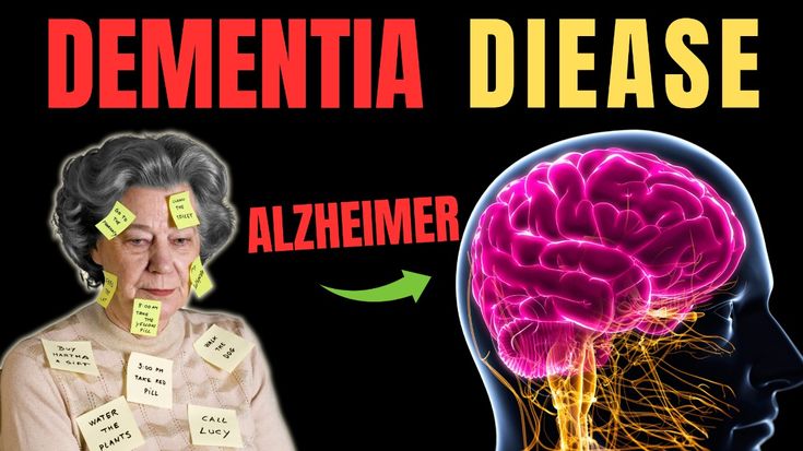 Beware! These Are Dementia Symptoms That Many People Often Overlook