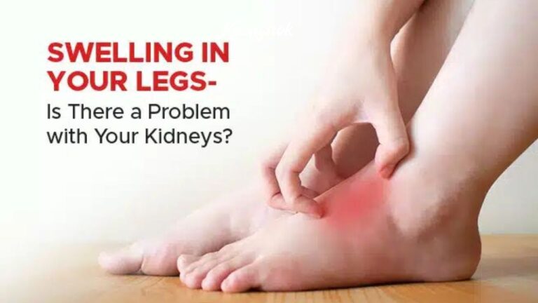 Beware of Swelling! The 3 Areas of Swelling That Indicate Liver and Kidney Problems