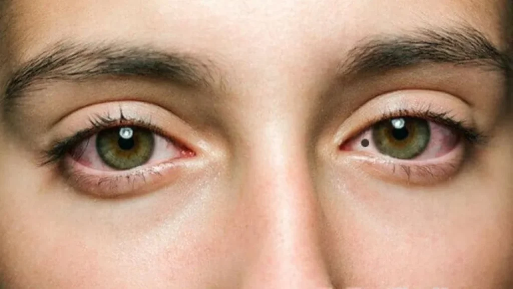 A mole’s meaning usually depends on location, left/right side, color, and whether it is hidden.