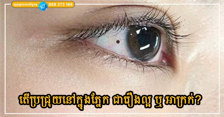 Is a mole in the eye a good or bad thing? Let’s look at all the predictions together.
